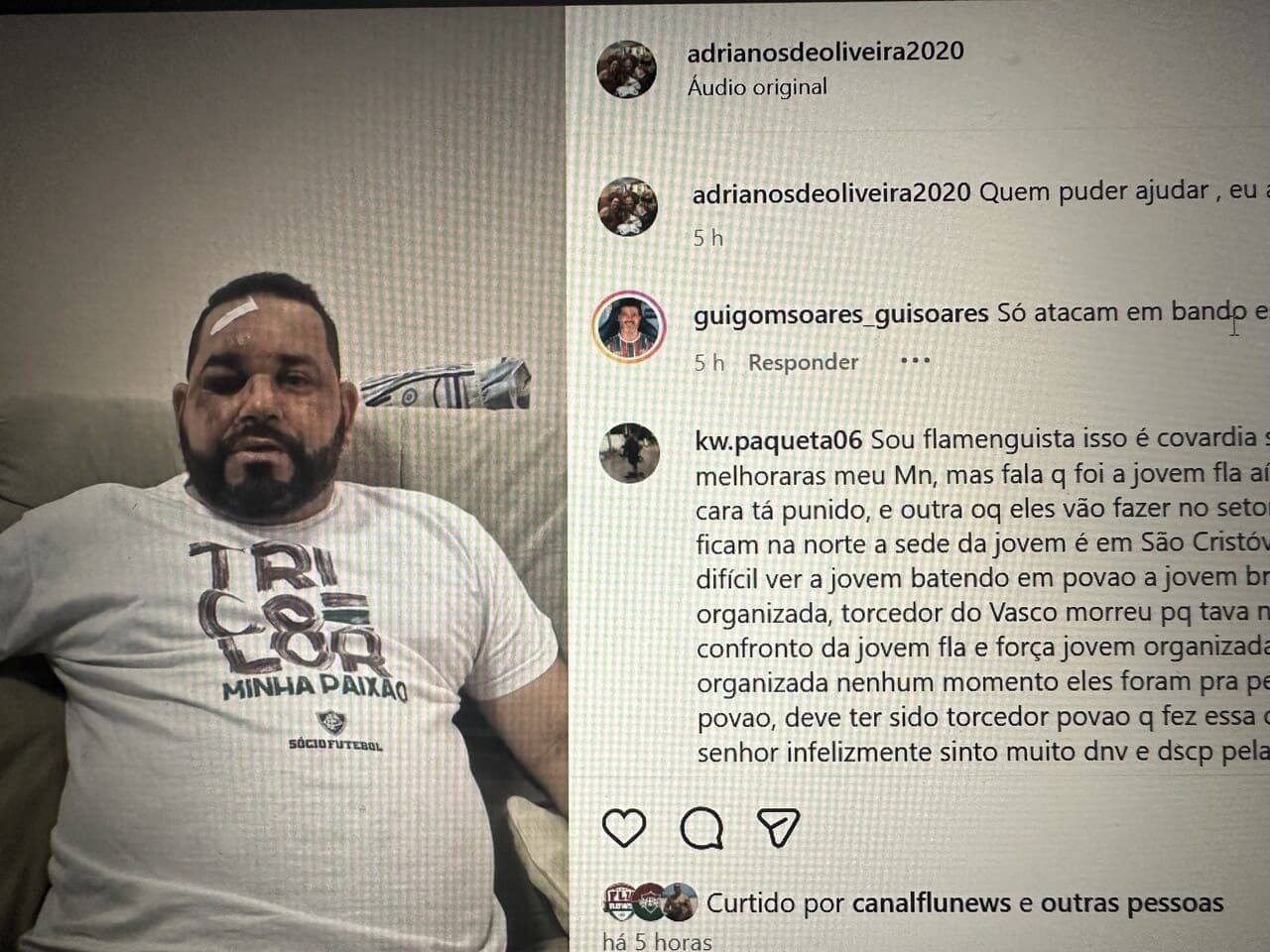 Agressão no Maracanã: Torcedor do Flu Espancado Após Fla-Flu