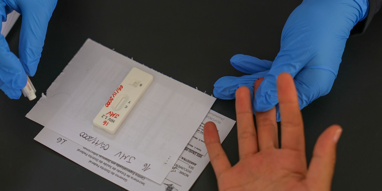 HIV/SUS: Brasil Busca Acordo para PrEP Injetável Semestral